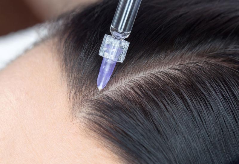 Introducing the best hair loss treatment drugs