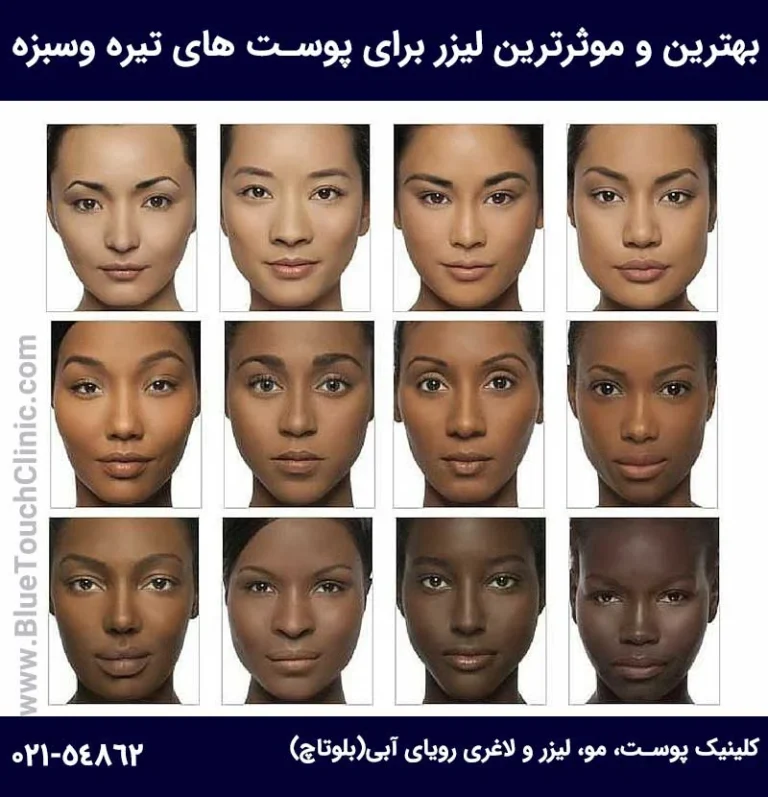 نظرات مردم در مورد بهترین دستگاه لیزر برای پوست تیره