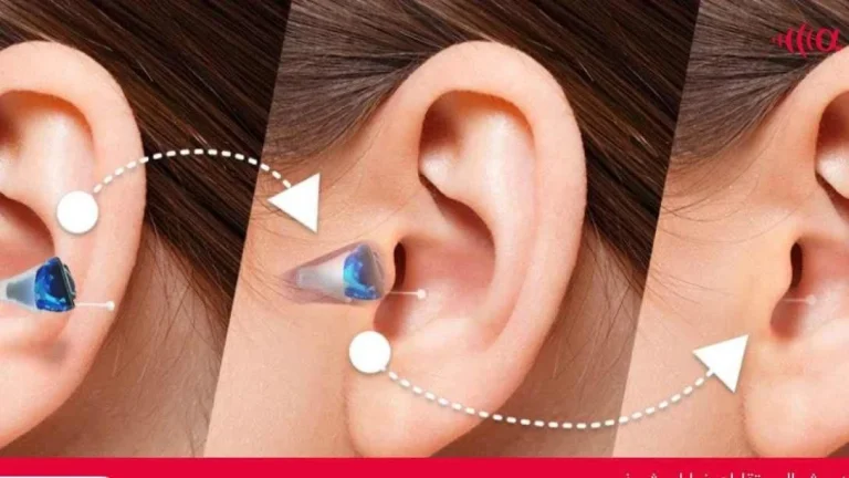 آیا سمعک شامل بیمه تامین اجتماعی می‌شود؟