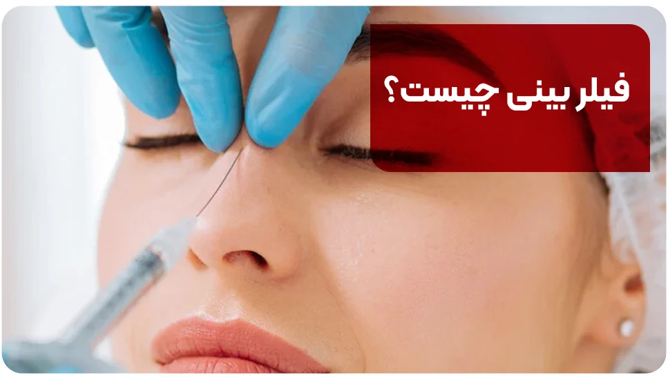 فیلر بینی چیست؟
